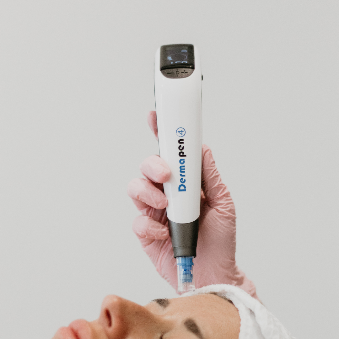 Microneedling – Soin de revitalisation cutanée personnalisé