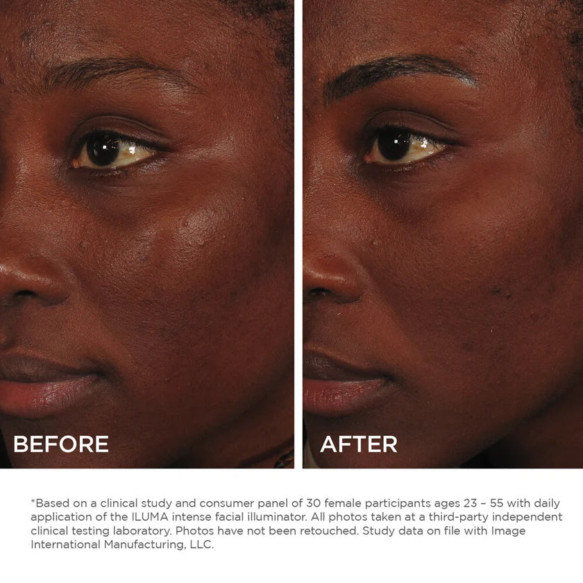 Illuminateur Visage Intense ILUMA Image Skincare – Sérum éclaircissant anti-taches Maison Épiderme Sainte-Hyacinthe