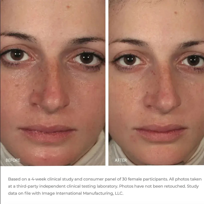 Masque Gel Apaisant et Équilibrant ORMEDIC Image Skincare – Soin hydratant calmant Maison Épiderme Sainte-Hyacinthe